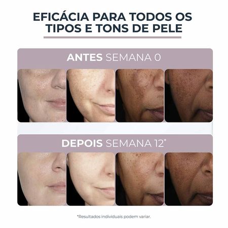 Creme-Facial-Eucerin-Anti-Pigment-Noite-50ml--6